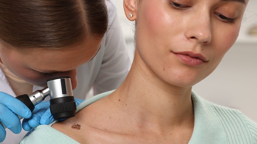 Znaczenie biopsji węzła wartowniczego w ocenie rokowania u chorych na czerniaka