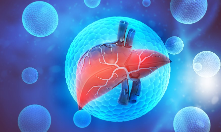 MAFLD/NAFLD – okiem gastroenterologa. Powikłania nowotworowe